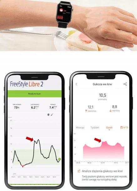 Smartwatch Medykor zegarek glukometr pomiar poziom cukru